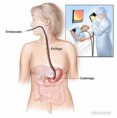 /album/fotogaleria/endoscopia-superior-jpg/